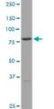 Transglutaminase 4 antibody, H00007047-B01P, Novus Biologicals, Western Blot image 