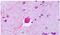 P2Y Receptor Family Member 8 antibody, GTX13107, GeneTex, Immunohistochemistry paraffin image 