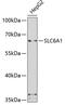 Solute Carrier Family 6 Member 1 antibody, GTX55801, GeneTex, Western Blot image 