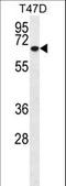 Matrix Metallopeptidase 2 antibody, LS-C164242, Lifespan Biosciences, Western Blot image 