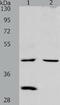 Neutral Cholesterol Ester Hydrolase 1 antibody, TA323967, Origene, Western Blot image 