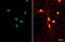 ETS Variant 1 antibody, GTX129202, GeneTex, Immunofluorescence image 