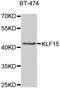 Kruppel Like Factor 15 antibody, LS-C346274, Lifespan Biosciences, Western Blot image 