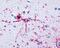 Forkhead Box O1 antibody, GTX70189, GeneTex, Immunohistochemistry paraffin image 