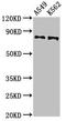 Calpain 1 antibody, LS-C677382, Lifespan Biosciences, Western Blot image 