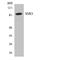 Smoothened, Frizzled Class Receptor antibody, LS-C200709, Lifespan Biosciences, Western Blot image 