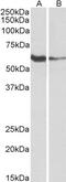 Fc Receptor Like 1 antibody, 43-660, ProSci, Western Blot image 