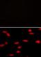 Lysine Methyltransferase 5A antibody, orb94499, Biorbyt, Immunofluorescence image 