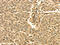 Septin 2 antibody, CSB-PA033044, Cusabio, Immunohistochemistry paraffin image 