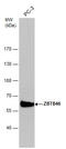Zinc Finger And BTB Domain Containing 46 antibody, GTX121617, GeneTex, Western Blot image 