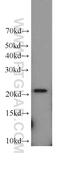 Tumor necrosis factor alpha-induced protein 8 antibody, 15790-1-AP, Proteintech Group, Western Blot image 