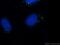 Tubulin Gamma 1 antibody, 26195-1-AP, Proteintech Group, Immunofluorescence image 