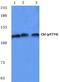 Cbl Proto-Oncogene antibody, PA5-36734, Invitrogen Antibodies, Western Blot image 