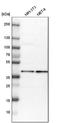 Mitochondrial Ribosomal Protein S22 antibody, NBP1-86787, Novus Biologicals, Western Blot image 