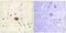 Ras Protein Specific Guanine Nucleotide Releasing Factor 1 antibody, GTX87849, GeneTex, Immunohistochemistry paraffin image 