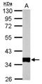 Pyruvate Dehydrogenase E1 Beta Subunit antibody, NBP2-20024, Novus Biologicals, Western Blot image 