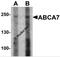 ATP Binding Cassette Subfamily A Member 7 antibody, 6889, ProSci Inc, Western Blot image 