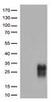Cytotoxic T-lymphocyte protein 4 antibody, CF813086, Origene, Western Blot image 