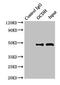 Glutaryl-CoA Dehydrogenase antibody, LS-C397916, Lifespan Biosciences, Immunoprecipitation image 