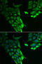 Hyaluronan Binding Protein 2 antibody, STJ28999, St John