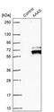 Aladin WD Repeat Nucleoporin antibody, PA5-59060, Invitrogen Antibodies, Western Blot image 