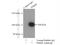 Phosphatidylinositol 4-Kinase Beta antibody, 13247-1-AP, Proteintech Group, Immunoprecipitation image 