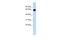 Beta-1,3-N-Acetylgalactosaminyltransferase 2 antibody, A09805, Boster Biological Technology, Western Blot image 