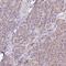 ATP Synthase Peripheral Stalk-Membrane Subunit B antibody, HPA057347, Atlas Antibodies, Immunohistochemistry paraffin image 