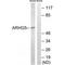 GEF5 antibody, PA5-50117, Invitrogen Antibodies, Western Blot image 