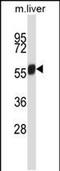 NIMA Related Kinase 3 antibody, PA5-48646, Invitrogen Antibodies, Western Blot image 