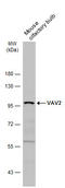 Vav Guanine Nucleotide Exchange Factor 2 antibody, GTX131451, GeneTex, Western Blot image 