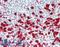 Glycoprotein Ib Platelet Subunit Alpha antibody, LS-B15400, Lifespan Biosciences, Immunohistochemistry paraffin image 