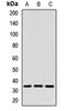 Coatomer Protein Complex Subunit Epsilon antibody, LS-C668649, Lifespan Biosciences, Western Blot image 