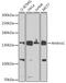 Autophagy And Beclin 1 Regulator 1 antibody, GTX55507, GeneTex, Western Blot image 