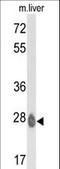 ETHE1 Persulfide Dioxygenase antibody, LS-B10538, Lifespan Biosciences, Western Blot image 