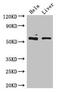 Keratin 81 antibody, CSB-PA012576LA01HU, Cusabio, Western Blot image 