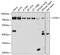 Lysyl Oxidase Like 1 antibody, GTX64529, GeneTex, Western Blot image 