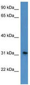 Rhophilin Associated Tail Protein 1 Like antibody, TA342989, Origene, Western Blot image 