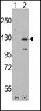Dishevelled Associated Activator Of Morphogenesis 1 antibody, PA5-12292, Invitrogen Antibodies, Western Blot image 
