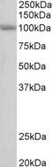 Corticosteroid 11-beta-dehydrogenase isozyme 1 antibody, 42-861, ProSci, Enzyme Linked Immunosorbent Assay image 