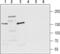 Transient Receptor Potential Cation Channel Subfamily M Member 3 antibody, PA5-77327, Invitrogen Antibodies, Western Blot image 