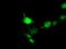 Doublecortin antibody, NBP2-03081, Novus Biologicals, Immunocytochemistry image 