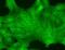Transient Receptor Potential Cation Channel Subfamily C Member 7 antibody, NBP1-48318, Novus Biologicals, Immunofluorescence image 