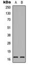 Receptor Activity Modifying Protein 1 antibody, LS-C358268, Lifespan Biosciences, Western Blot image 