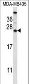 Calcium Binding Protein 5 antibody, LS-C168255, Lifespan Biosciences, Western Blot image 