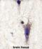 Leucine Rich Repeat And Ig Domain Containing 1 antibody, abx033300, Abbexa, Immunohistochemistry frozen image 