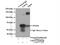 Ubiquitin Specific Peptidase 14 antibody, 14517-1-AP, Proteintech Group, Immunoprecipitation image 