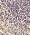 Beta-Actin antibody, M01263-3, Boster Biological Technology, Immunohistochemistry paraffin image 