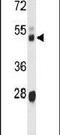 Cytochrome P450 Family 3 Subfamily A Member 43 antibody, PA5-26009, Invitrogen Antibodies, Western Blot image 