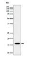 Elongin B antibody, M31718, Boster Biological Technology, Western Blot image 